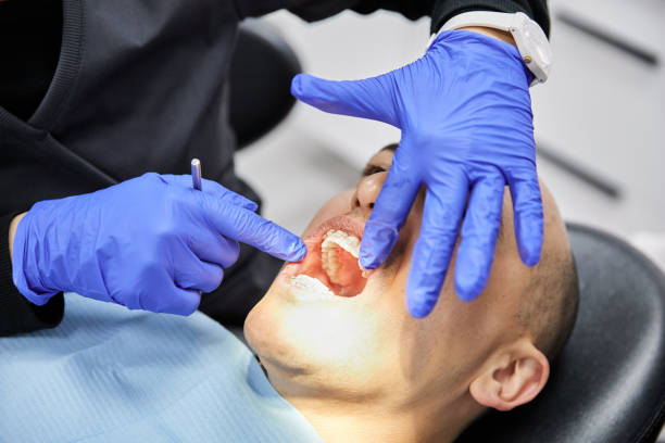 Best Emergency Wisdom Teeth Removal in Mishicot, WI